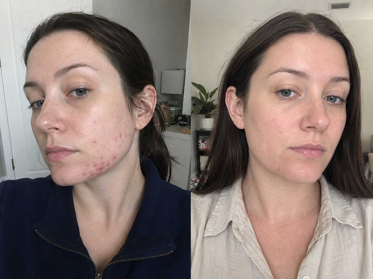 Jordan T., 27 before and after