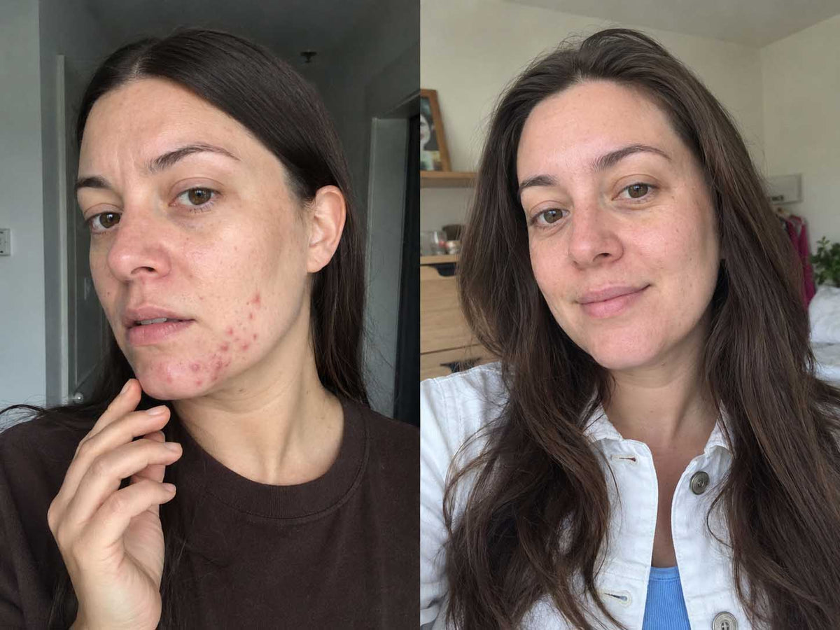 Daniel K., 31 before and after