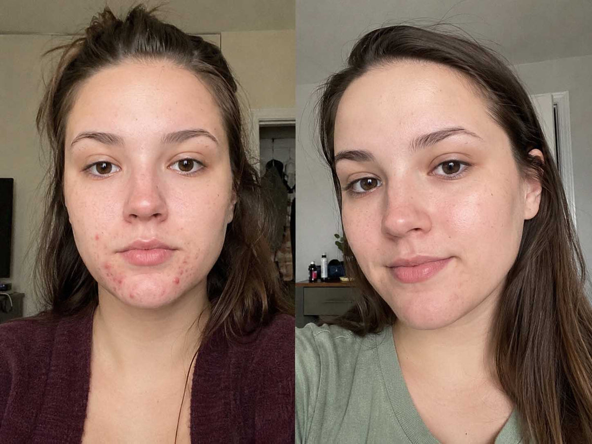 Sofia M., 26 before and after