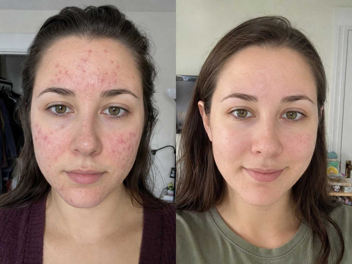 Vanessa R., 27 before and after