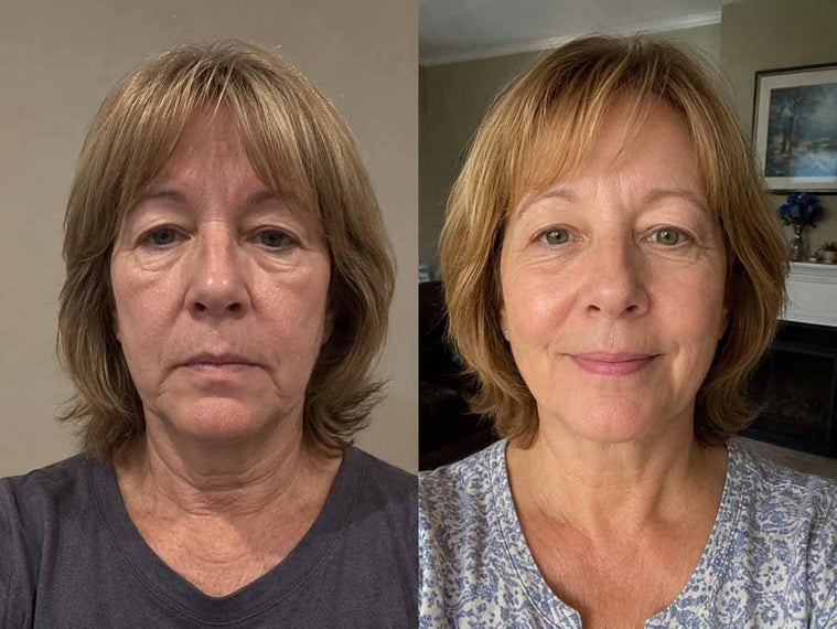 Carol M., 58 before and after