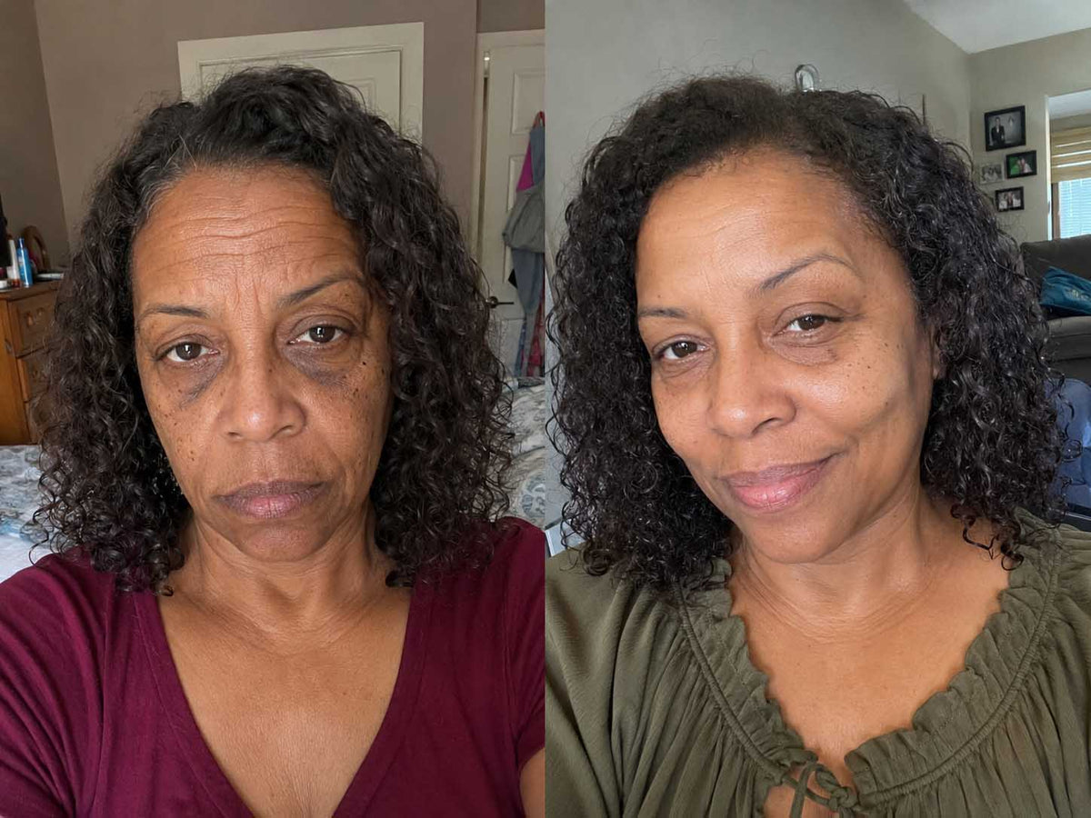 Tanisha R., 46 before and after