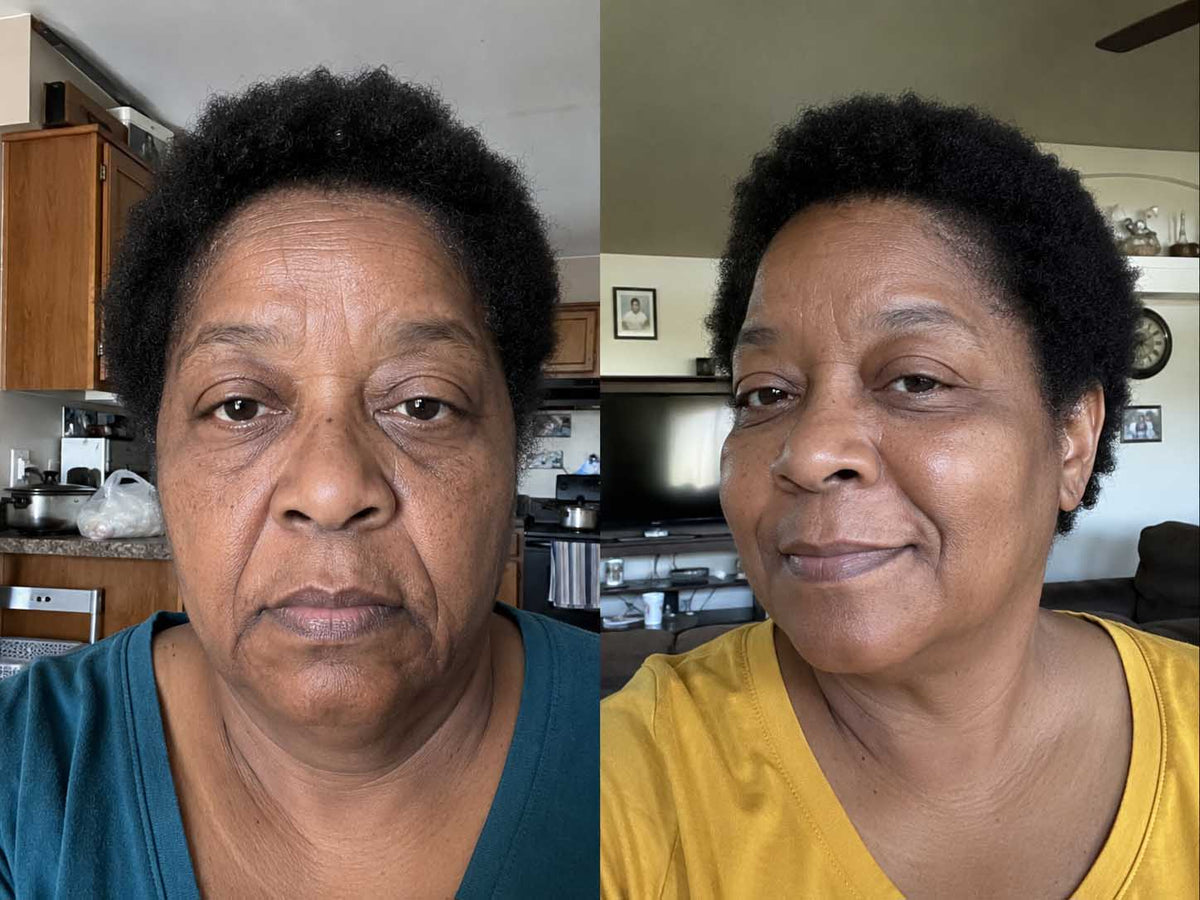 Yolanda B., 53 before and after