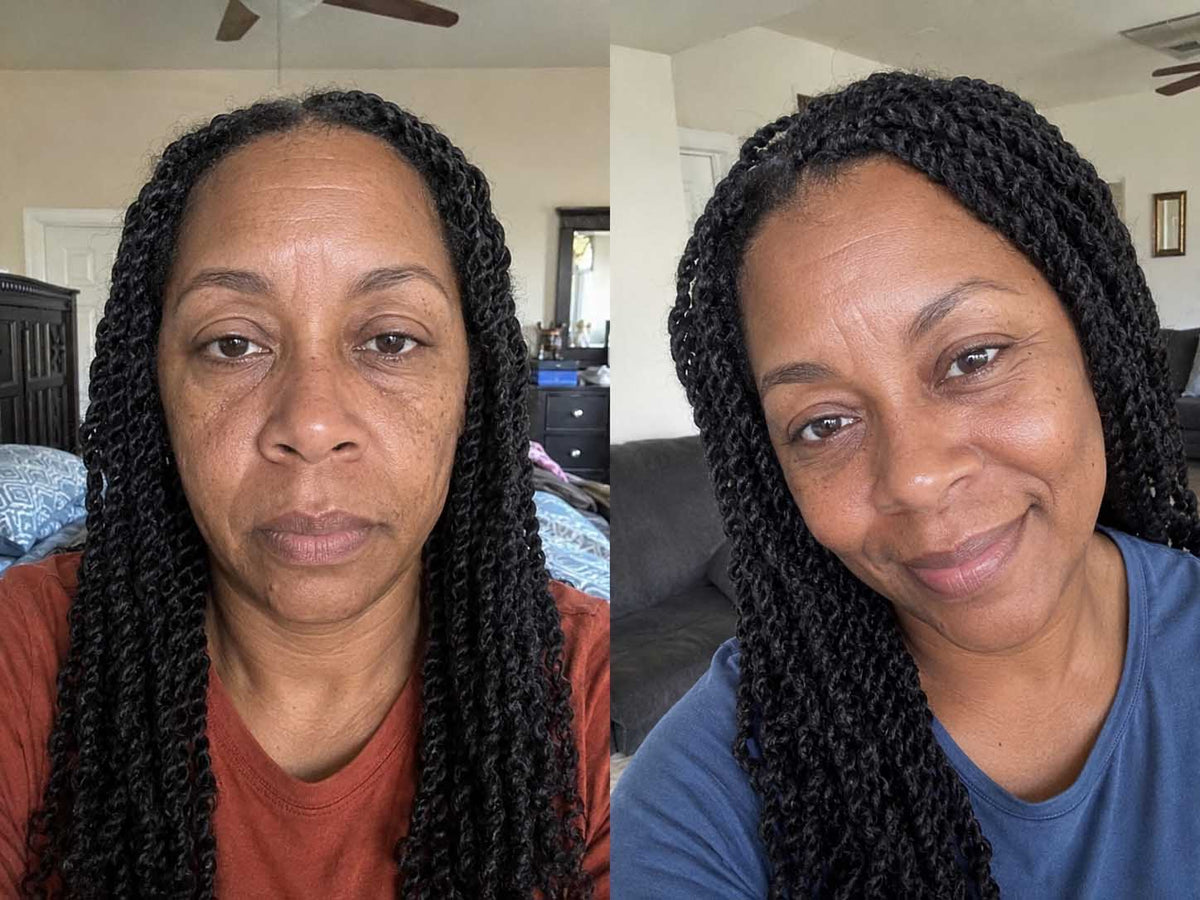 Crystal J., 42 before and after