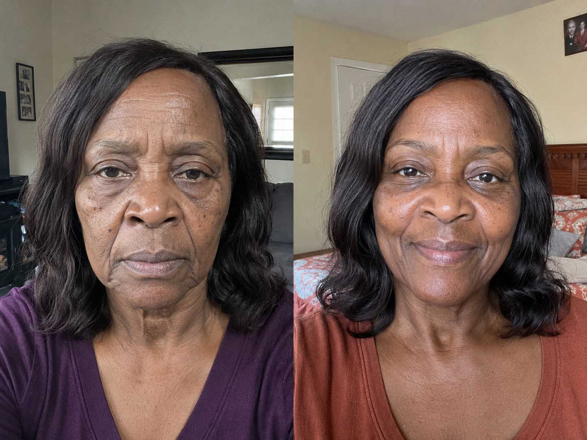 Gloria T., 58 before and after