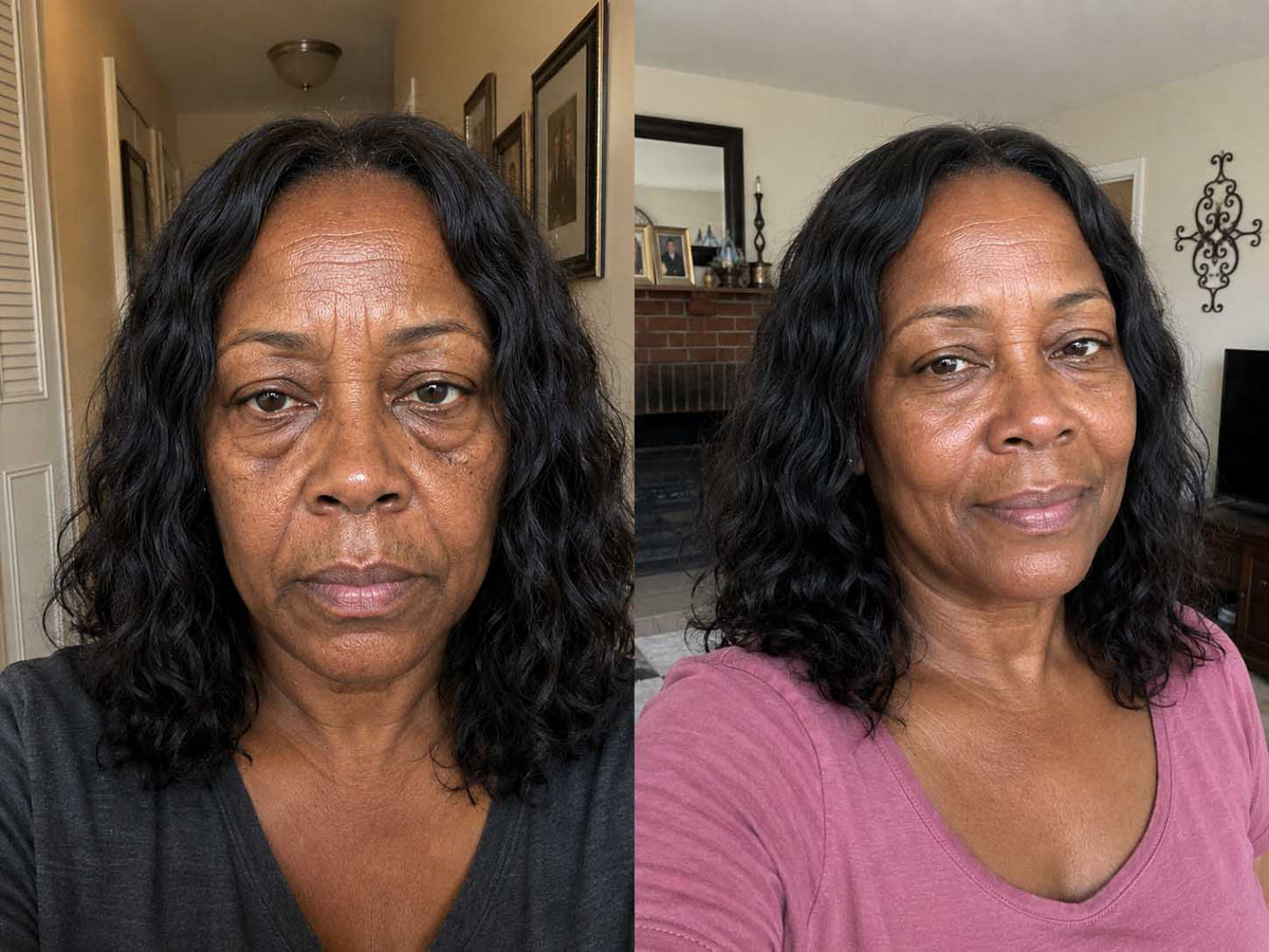 Renee H., 50 before and after