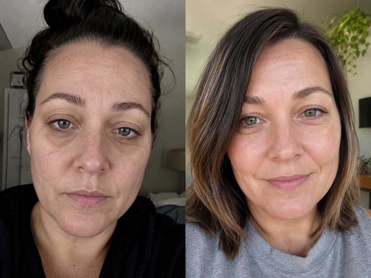 Karen K., 46 before and after