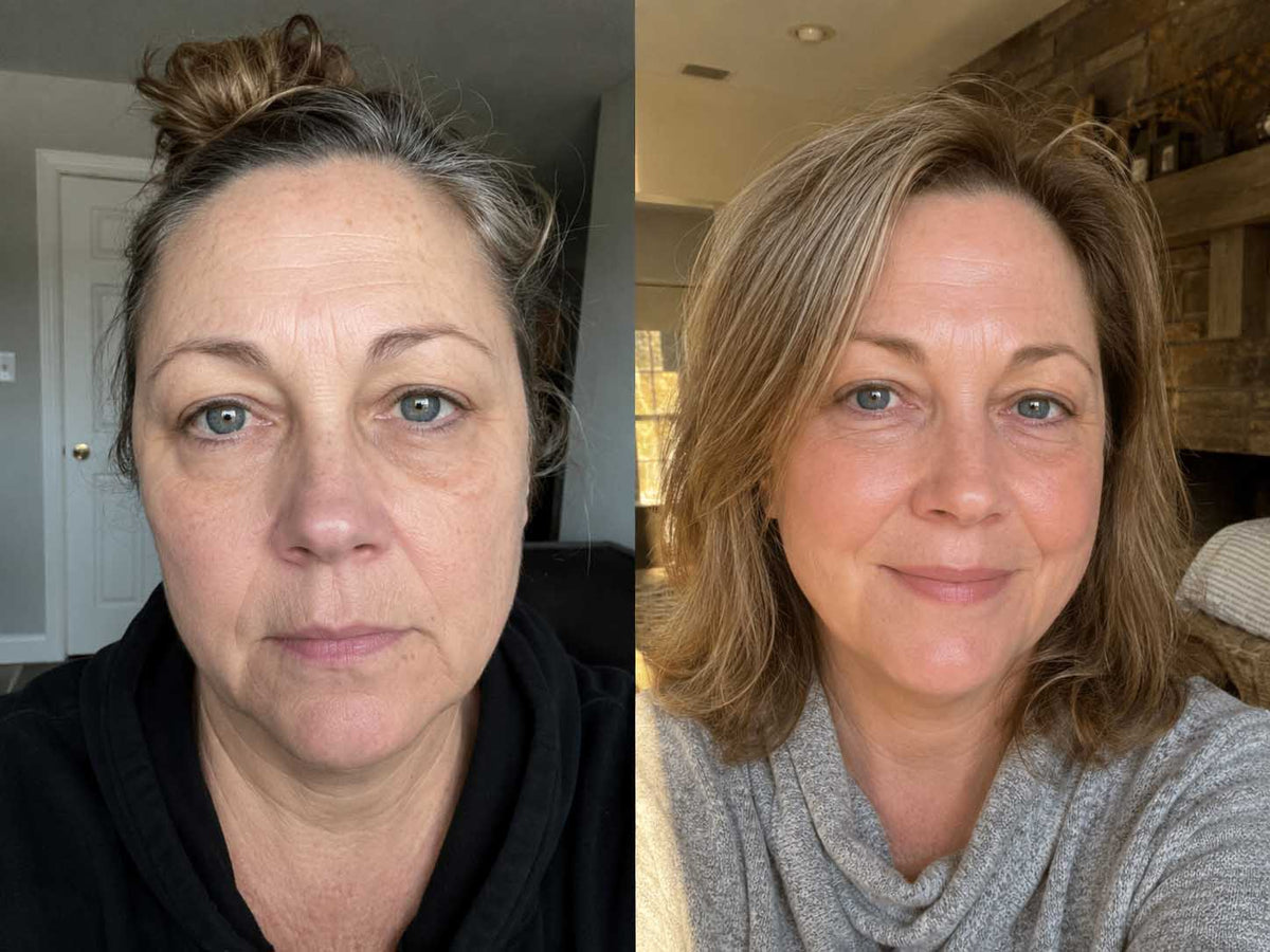 Joan W., 53 before and after