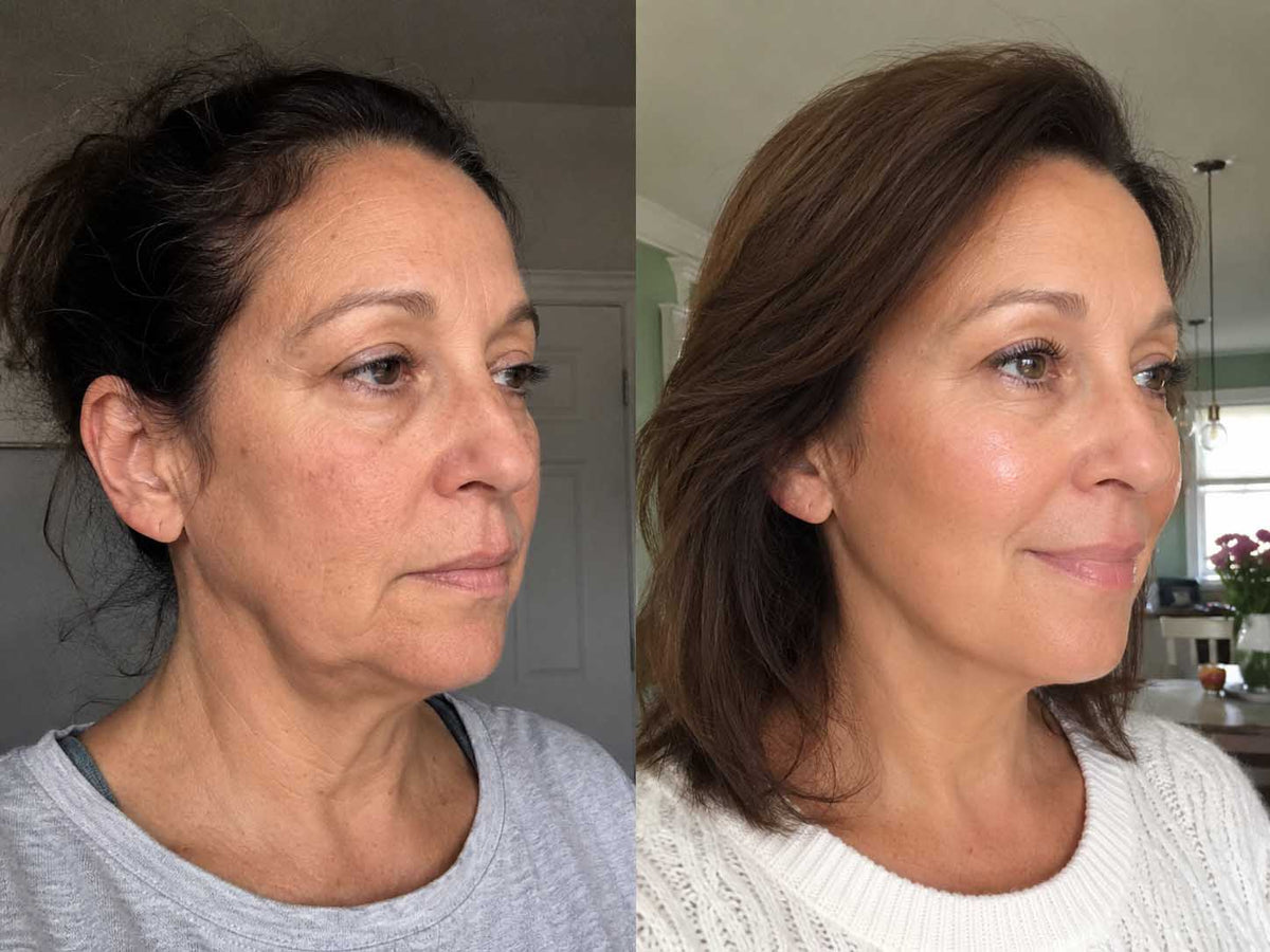 Lisa S., 55 before and after