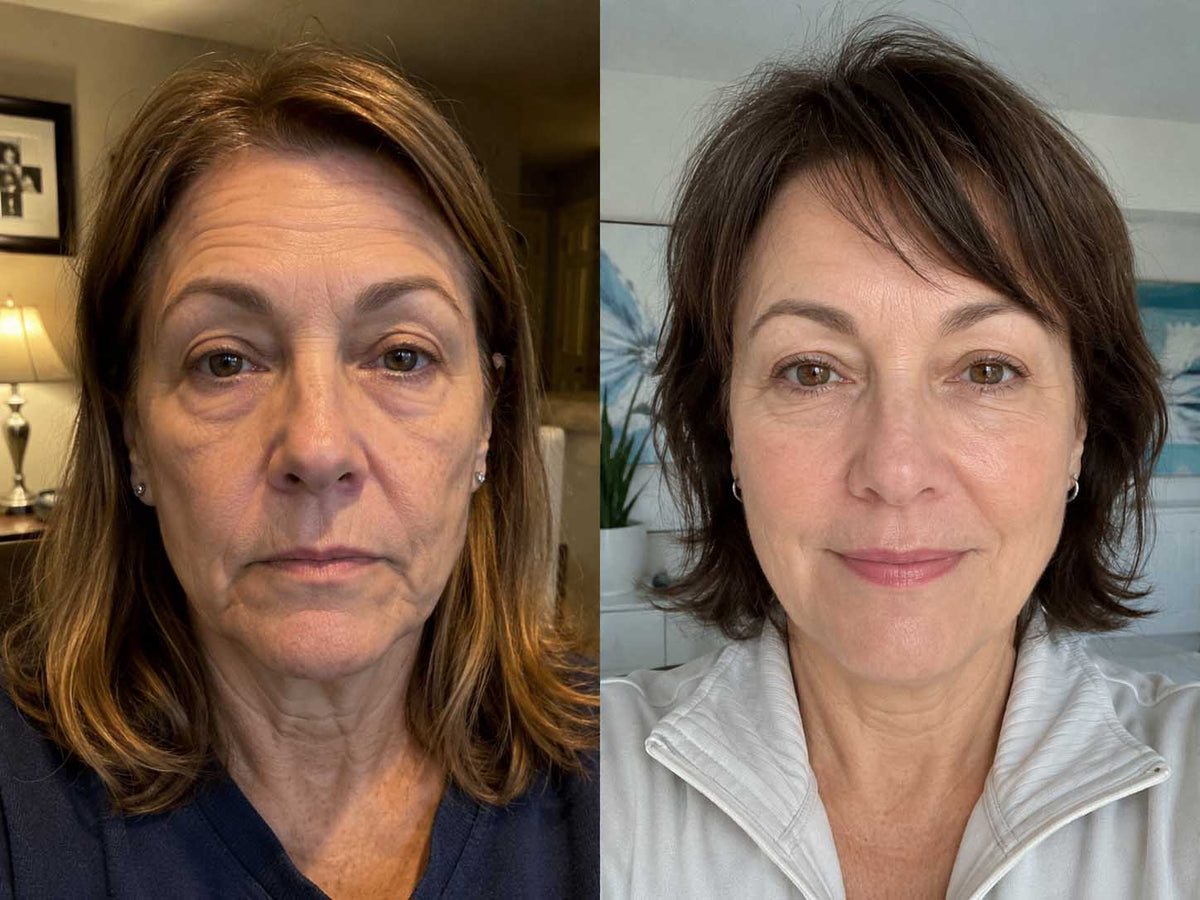 Carol M., 58 before and after