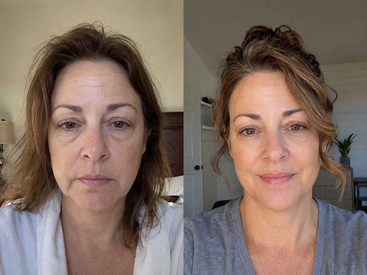 Sheila K., 50 before and after