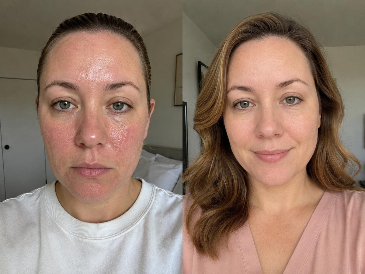 ORI1 Collagen Strips before and after