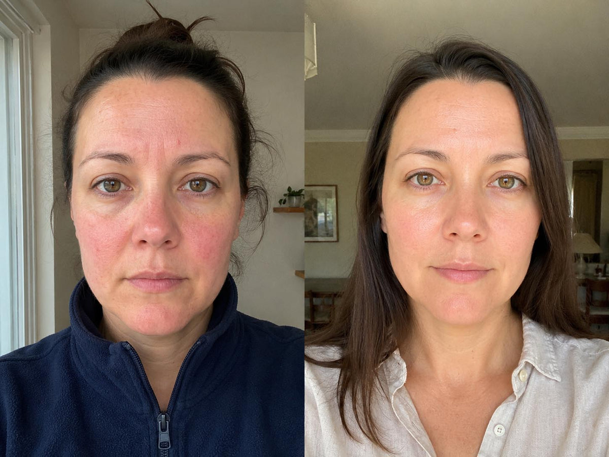 Joan W., 41 before and after