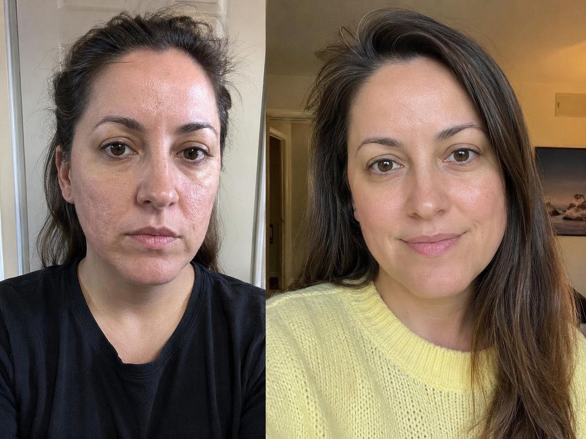 Lisa S., 38 before and after