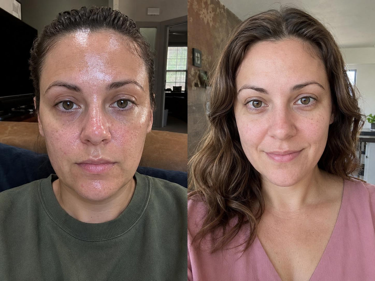 Nicole D., 36 before and after