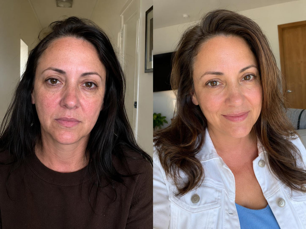 Carol M., 44 before and after