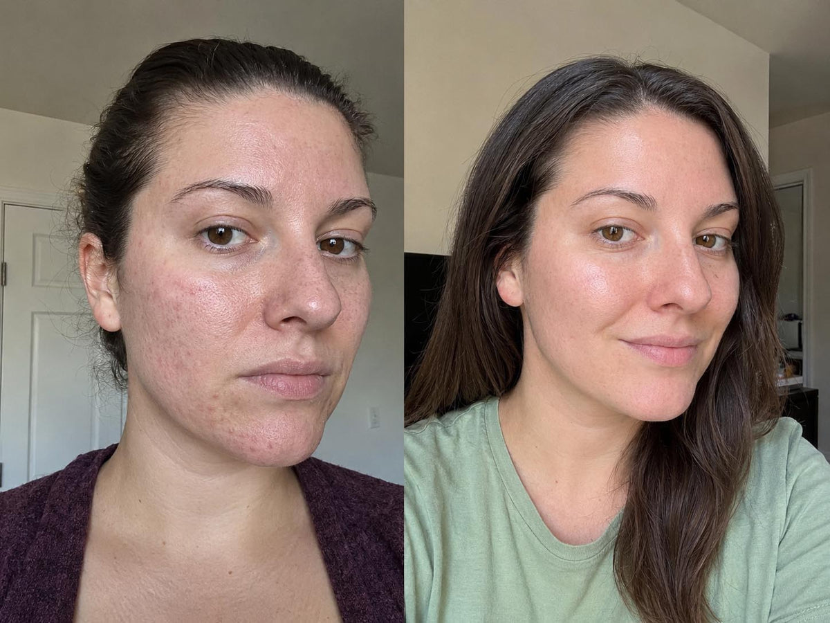 Sheila K., 39 before and after