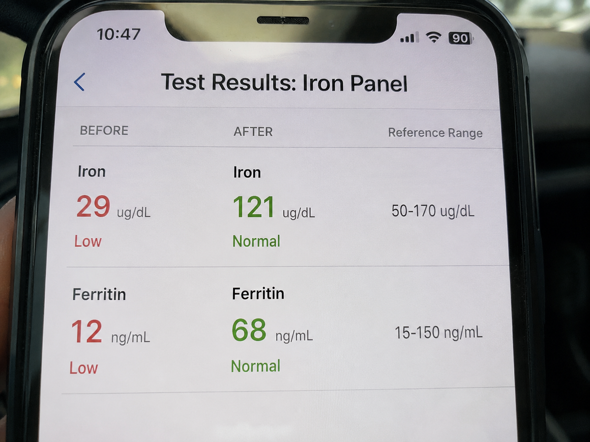 Holly T., 36 ferritin blood test before and after