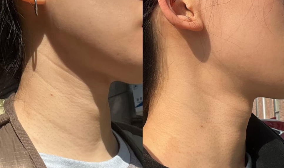 Nicole D., 36 before and after