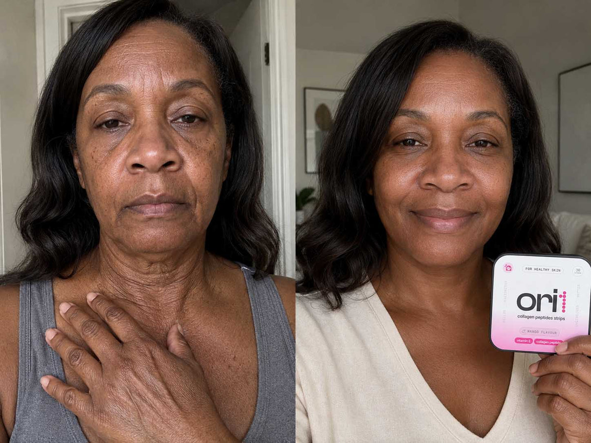 ORI1 Collagen Strips before and after