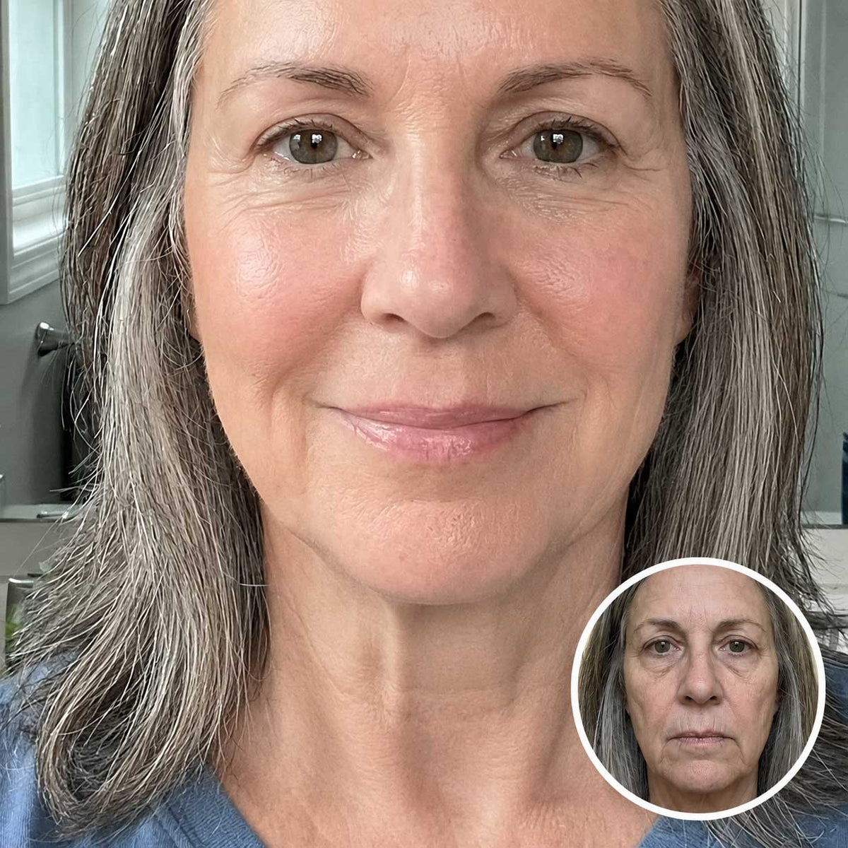 Margaret R., age 68, before and after twelve weeks of daily ORI1 sublingual collagen
