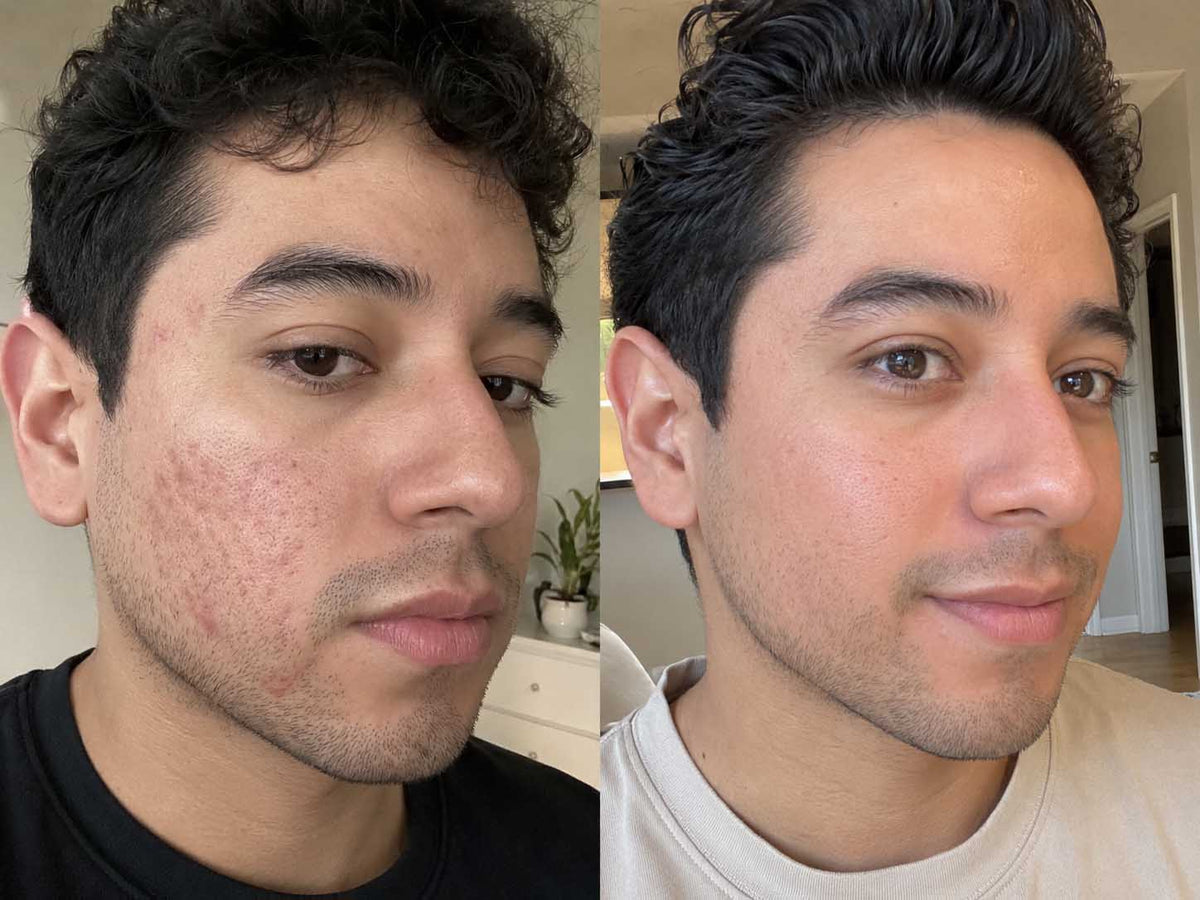 Jordan T., 27 before and after