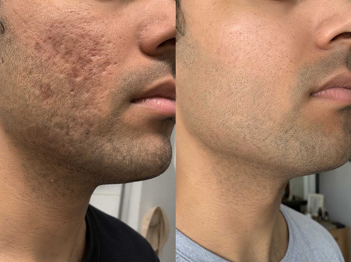 Daniel K., 31 before and after