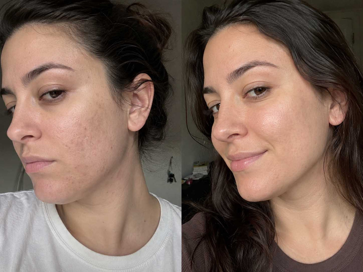 Sofia M., 26 before and after