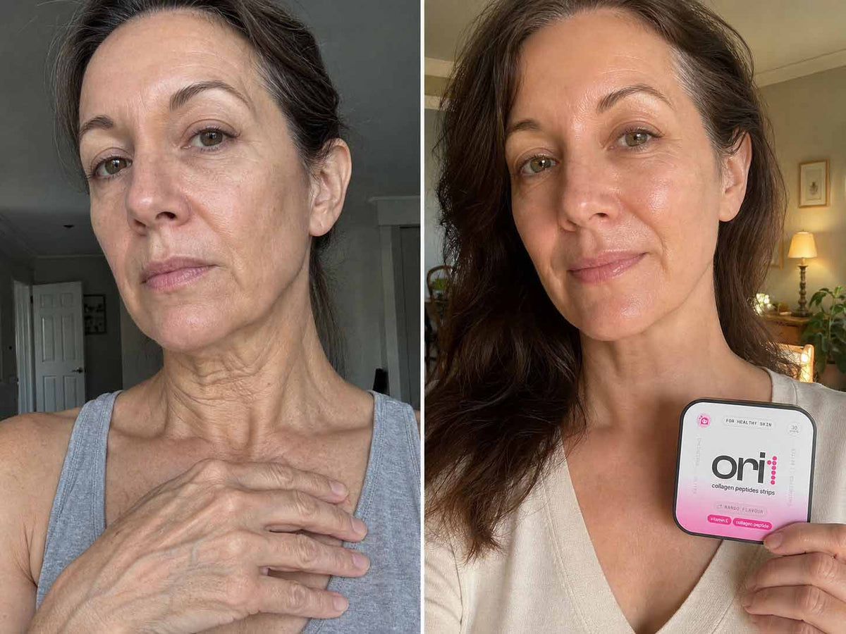 Collagen Peptides Strips