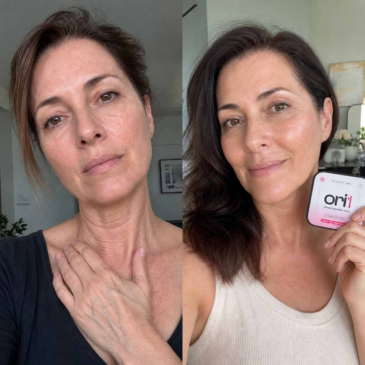Patient before and after, full result