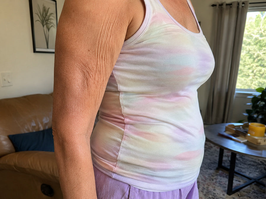 Crepey skin on upper arm