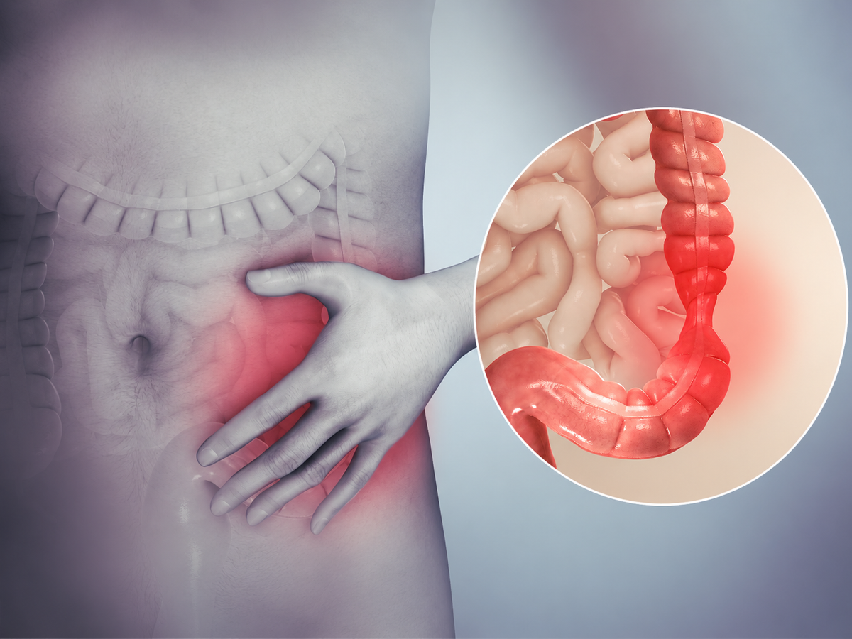 ORI1 Gut Health Strips for IBS